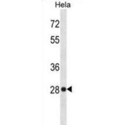 High Mobility Group Protein B1 (HMGB1) Antibody