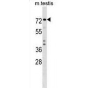 E3 Ubiquitin-Protein Ligase TRIM41 (TRIM41) Antibody