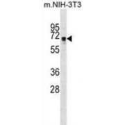 NADPH-Dependent Diflavin Oxidoreductase 1 (NDOR1) Antibody