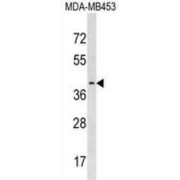 Platelet-Activating Factor Acetylhydrolase 2, Cytoplasmic (PAFAH2) Antibody