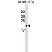 ADP-Ribosylation-Like Factor 6 Interacting Protein 5 (ARL6IP5) Antibody