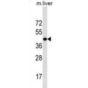 NK2 Homeobox 5 (NKX2-5) Antibody