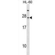 Lymphocyte Antigen 96 (LY96) Antibody