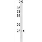 Serine/arginine-Rich Splicing Factor 10 (FUSIP1) Antibody