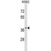 Single Strand Selective Monofunctional Uracil DNA Glycosylase 1 (SMUG1) Antibody