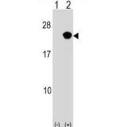 RAP2B, Member of RAS Oncogene Family (RAP2B) Antibody