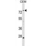 Actin-Binding LIM Protein 3 (ABLIM3) Antibody