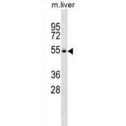 Mouse Vrk2 Antibody