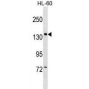 PWP2, UTPB SSU Processome Subunit (PWP2) Antibody