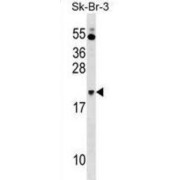 NFKB Inhibitor Interacting Ras Like 1 (NKIRAS1) Antibody