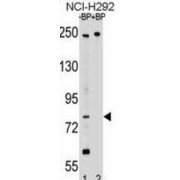 DCC-Interacting Protein 13-Beta (APPL2) Antibody