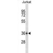 Zinc Finger Protein 346 (ZNF346) Antibody
