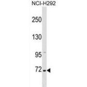 Zinc Finger Protein 571 (ZNF571) Antibody