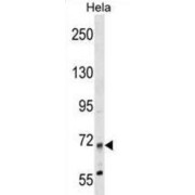 Myotubularin-Related Protein 14 (MTMR14) Antibody