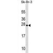 abx029558