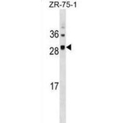 Kinetochore Protein Spc25 (SPC25) Antibody