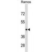 RGM Domain Family Member B (RGMB) Antibody