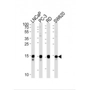 Transcription Elongation Factor A Like 1 (TCEAL1) Antibody