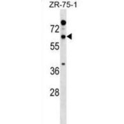 Reticulon 2 (RTN2) Antibody
