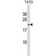 COMM Domain Containing Protein 9 (COMMD9) Antibody