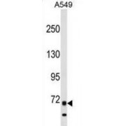 Tyrosine-Protein Kinase ITK/TSK (ITK) Antibody