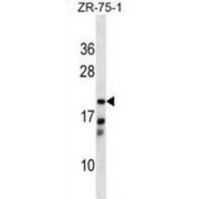 Carbonyl Reductase Family Member 4 (CBR4) Antibody