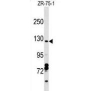 Coiled-Coil Domain-Containing Protein 132 (CCDC132) Antibody