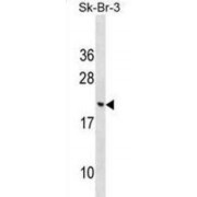 Protein Cornichon Homolog 3 (CNIH3) Antibody
