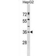 Endoplasmic Reticulum Resident Protein 27 (ERP27) Antibody