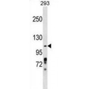 Zinc Finger And BTB Domain-Containing Protein 4 (ZBTB4) Antibody