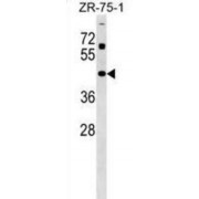 Zinc Finger Protein 323 (ZNF323) Antibody