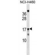 Mitochondrial Ribosomal Protein S11 (MRPS11) Antibody