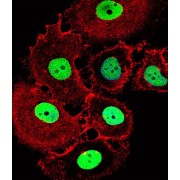 Homeobox Protein Hox-C10 (HOXC10) Antibody