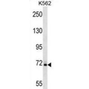 Deoxynucleoside Triphosphate Triphosphohydrolase SAMHD1 (SAMHD1) Antibody