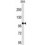 V-Myb Myeloblastosis Viral Oncogene Homolog Like Protein 1 (MYBL1) Antibody
