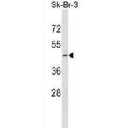 Queuine tRNA-Ribosyltransferase Catalytic Subunit 1 (QTRT1) Antibody