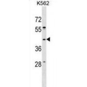 SPO11, Initiator of Meiotic Double Stranded Breaks (SPO11) Antibody