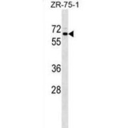 SRP Receptor Alpha Subunit (SRPR) Antibody