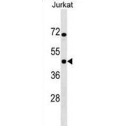 Inhibitor of Nuclear Factor Kappa-B Kinase-Interacting Protein (IKBIP) Antibody