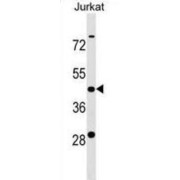 BTB/POZ Domain-Containing Protein KCTD9 (KCTD9) Antibody