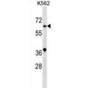 Ankyrin Repeat And SOCS Box Containing 10 (ASB10) Antibody