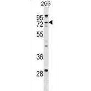Zinc Finger CCHC Domain-Containing Protein 8 (ZCCHC8) Antibody