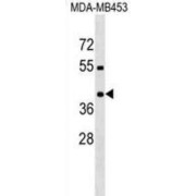 Proline-Rich Transmembrane Protein 2 (PRRT2) Antibody