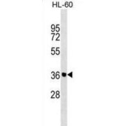 Zinc Finger Protein 785 (ZNF785) Antibody