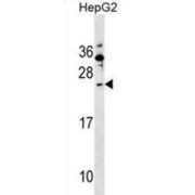 Protein Shisa-5 (SHISA5) Antibody