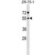 Archain 1 (ARCN1) Antibody
