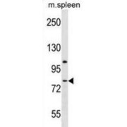 Latrophilin 3 / LPHN3 (ADGRL3) Antibody