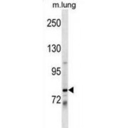 Dachshund Homolog 1 (DACH1) Antibody