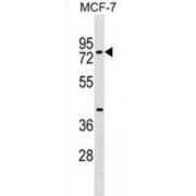 WB analysis of MCF-7 cell line lysates.