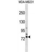 Sodium Channel Epithelial 1 Delta Subunit (SCNN1D) Antibody